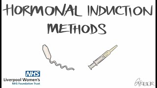 Hormonal Induction Methods [upl. by Dwight]