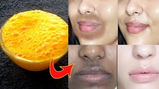 Remove Black Patches Around Mouth amp Forhead Upper Lips Skin Whitening Pack [upl. by Naitsirhc]