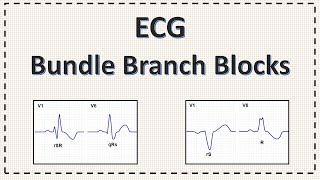 Bundle Branch Block  ECG  Right Bundle Branch Block  Left Bundle Branch Block  Explained [upl. by Daukas901]