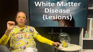 White matter lesions in cases of cervical instability  Ross Hauser MD [upl. by Cooper]