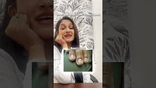 WHAT I SEE WHEN I SEE YOUR NAILS  Dr Tanvi Vaidya [upl. by Bordy]