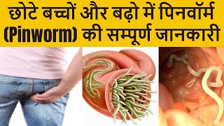 बढ़ो और बच्चों में पिनवॉर्म Pinworm की सम्पूर्ण जानकारी लक्षण इलाज दवा और बचाव के तरीके [upl. by Leander]