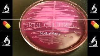 Urine Culture Growth Plates [upl. by Oflodor283]