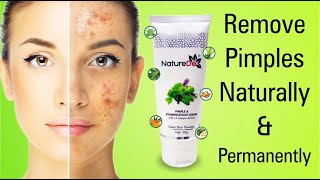 मुंहासों की समस्या से झटपट छुटकारा  pimple and pigmentation Cream [upl. by Yearwood]