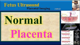 Fetus Ultrasound  Normal Placenta [upl. by Etteoj]