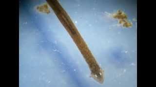 Planaria Phylum Platyhelminthes [upl. by Luebke]