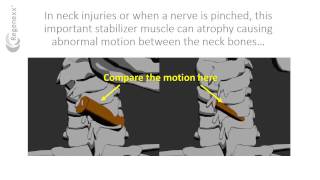 What is the multifidus function [upl. by Sax]