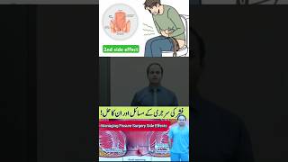 Managing Fissure Surgery Side Effects drimtiazhussain viralshorts [upl. by Aioj143]