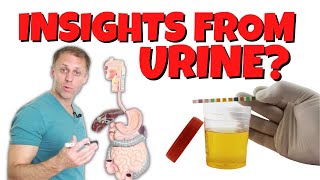 What Can You Learn From Your Urine [upl. by Lombardi]