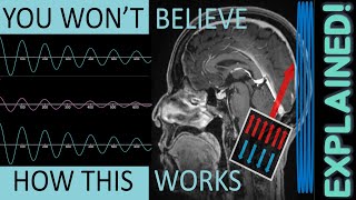 MRI Physics FULLY Explained  MRI Physics Course Lecture 1 [upl. by Quentin]