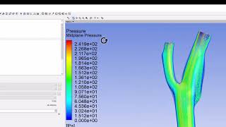 Numerical Results Velocity Profiles and Contours  Steady Flow in an Artery [upl. by Ditmore]