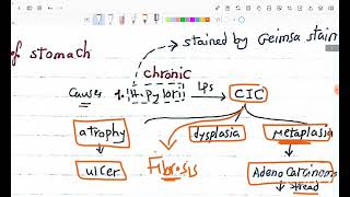 pathology of the stomach [upl. by Arihppas111]