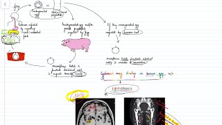 Taenia solium amp saginata Life cycle Neurocysticercosis Parasitology  neetpg inicet [upl. by Anicnarf]