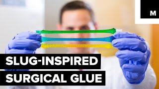 Inspired by Slug Slime This Surgical Glue Is Strong Enough to Patch up a Beating Heart [upl. by Rochell]