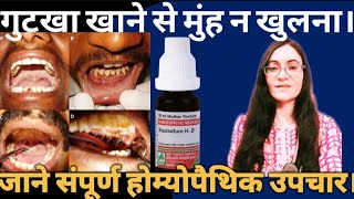 मुंह का कम खुलना कारण संपूर्ण इलाज oral submucous fibrosis I difficult to open mouth होम्योपैथी इलाज [upl. by Artemisa]