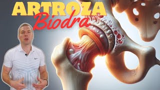 pokonaj swoje ZWYRODNIENIA BIODRA  trzask w biodrze endoproteza [upl. by Okin897]