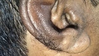 ASMR Ear Hair removal with barber Deep HairOrangeASMR741 [upl. by Alrad]