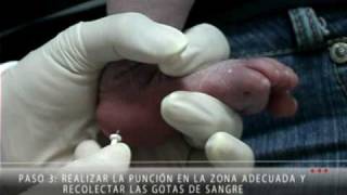 Forma Correcta de Recolectar la Muestra para el Tamiz Neonatal [upl. by Nata]