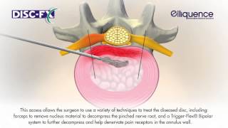 Disc FX Animation [upl. by Bel]