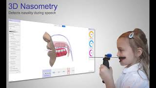 3D Nasometry [upl. by Bryana212]