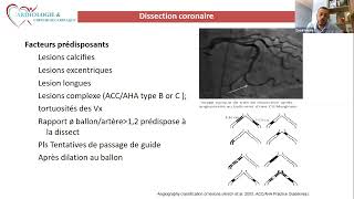 CSCWebinar 017 Gestion des complications du cathétérisme cardiaque interventionnel [upl. by Rozele]