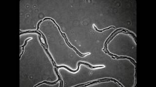 Myxobacteria  Moss Soil Isolate [upl. by Parish]