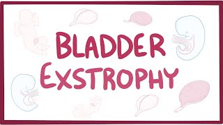 Bladder exstrophy  causes symptoms diagnosis treatment pathology [upl. by Hannie]