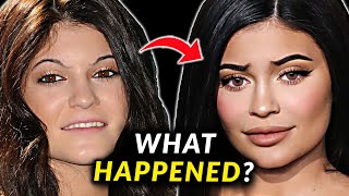 Kylie Jenners Face  Before and After [upl. by Gerge]