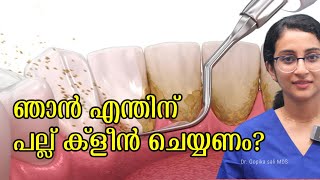 Tooth Cleaning  Teeth Scaling I Stain or Tartar Removal cost  Oral Hygiene Dentalexperiencein [upl. by Lemmor]