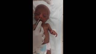 How to pass NG tube  Nasogastric Tube Insertion  medicalpoint8024 [upl. by Nnyllatsyrc581]