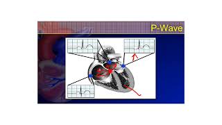 The 12Lead ECG Course  2a [upl. by Ilana]