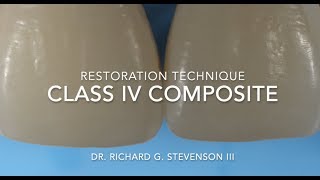 Class IV Composite Restoration  Restoration Technique [upl. by Wun]