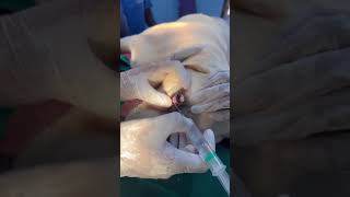 Nasolacrimal duct obstruction on a Labrador lykapetclinicdindigul [upl. by Surat]