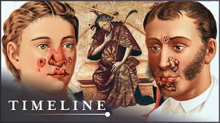 1495 Syphilis Outbreak The Deadly Disease That Swept Across Europe  The Syphilis Enigma  Timeline [upl. by Aniara596]