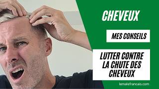 Perte des cheveux  Mes conseils pour ne plus stresser calvitie [upl. by Iatnohs]