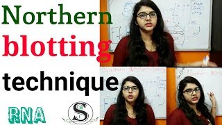 Northern blotting technique in hindi [upl. by Zacharias722]