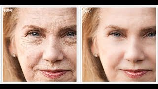 BEST ANTIAGING CREAM  AFFORDABLE  Revitol AntiAging Cream [upl. by Latrena]