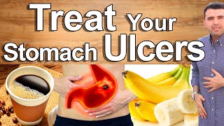 Do This And Cure Your Stomach Pain Gastritis and Ulcers  Best Natural Treatment of Stomach Pain [upl. by Normandy]