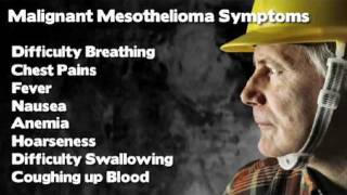 Mesothelioma Symptoms Diagnosing Asbestos Related Cancer [upl. by Marta]