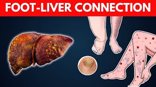 9 What Your Feet Can Tell You About Your Liver 12 Warning Signs  CHROMOSOMIUM [upl. by Emmy]