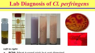 محاضرة الكلوستريديوم الجزء الثانى Clostridia Lecture Part II [upl. by Sellers]