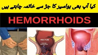 How To Get Rid Hemorrhoid [upl. by Ayar]