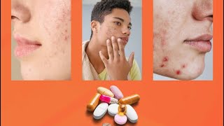 Get rid of all acne types with one tablet😎 [upl. by Yert]