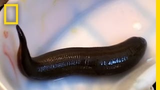 Leeches Cure  National Geographic [upl. by Afatsum]