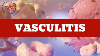 Aproximación a las Vasculitis [upl. by Benn]