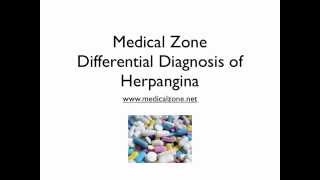 Medical Zone  Differential Diagnosis of Herpangina [upl. by Harbard]