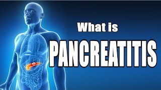 What is Pancreatitis  Cause amp Symptoms [upl. by Aramo]