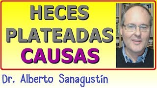 HECES PLATEADAS ▶ ¿Sabes las Causas [upl. by Held584]