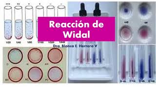 Reacción de Widal [upl. by Laverne]