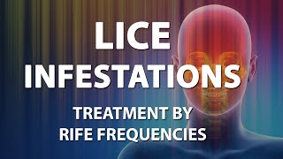 Lice Infestations Head  RIFE Frequencies Treatment  Energy amp Quantum Medicine with Bioresonance [upl. by Afatsum]